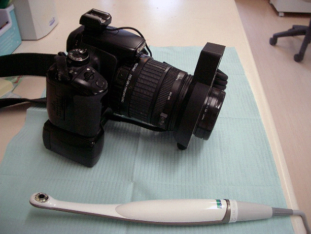 口の中を撮影するための専用のカメラ